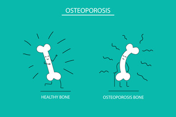 Cartoon of healthy bone and bone affected by osteoporosis