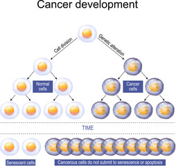 Wall Mural - Cancer cell development