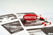 On the ultrasound pictures there are pills and a pen with the inscription - Hepatitis