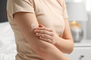 Wall Mural - Young woman with dry skin applying cream onto her arm indoors, closeup