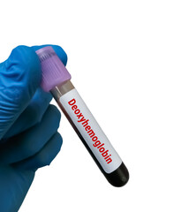 Poster - Deoxyhemoglobin or Reduced hemoglobin (RHb) test, hemoglobin which is not combined with oxygen