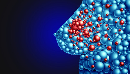 Wall Mural - cancer of the breast screening and metastatic spread to other parts of the human body as a symbol fo