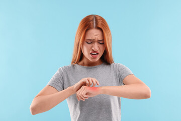 Wall Mural - Suffering from allergy. Young woman scratching her arm on light blue background