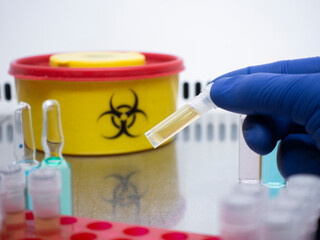 Poster - A dose of a bacterial antibiotic in a small test tube against the background of a yellow box, a hand in a blue glove holds a test tube with liquid.