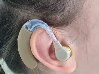 Child teenage girl on ear hearing aid