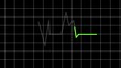 Digital heartbeat monitor with pulse line on a dark grid background.