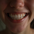 A close-up of a woman's teeth