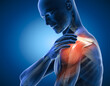 Painful shoulder joints. Frozen shoulder, Impingement. 3d illustration