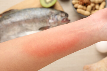 Wall Mural - Food allergy. Woman holding hand over products on table, closeup