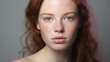 beautiful young woman with rosacea