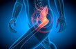 Walking man painful hip joint with blue background- x-ray illustration