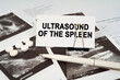 On the ultrasound pictures there is a pen and a business card with the inscription - Ultrasound of the spleen