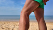 Close-up of a person's sunburnt leg showing a visible tan line , beach fly bites, beach flea bites, against a sandy beach backdrop on a sunny day, emphasizing sun protection awareness