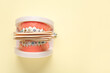 Model of jaw with dental braces and chewing gums on pale yellow background