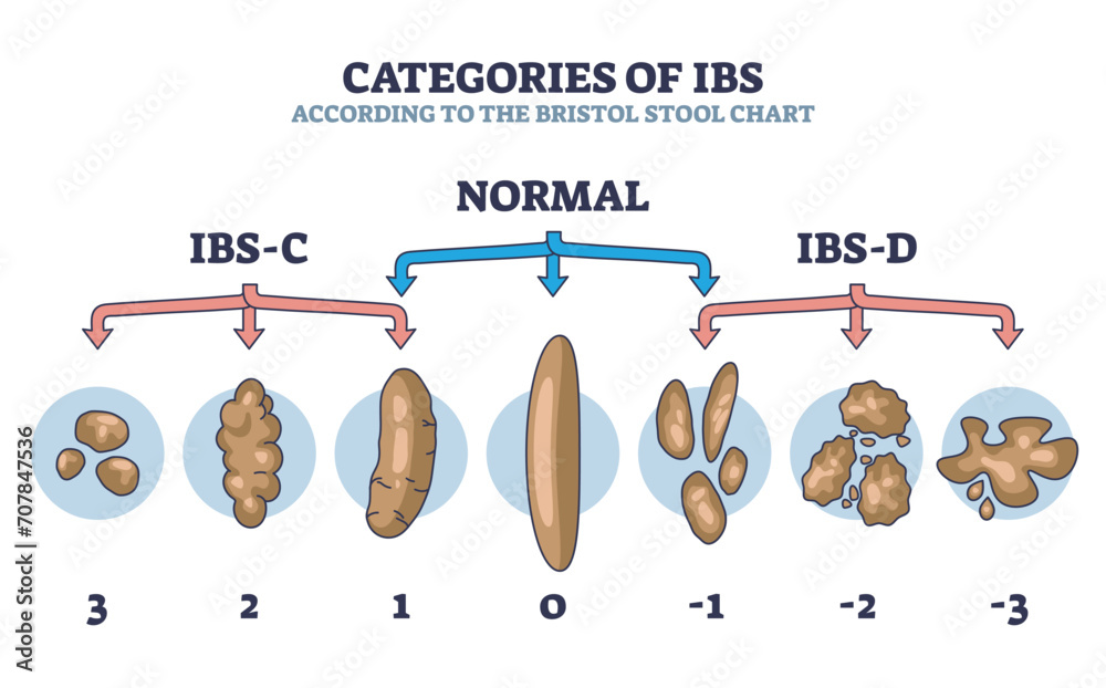 Categories of IBS stages according to bristol stool chart outline