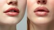 Close-up comparison of a woman's lips before and after a lip filler treatment. Ideal for beauty and cosmetic enhancement concepts