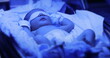 © Marco - Newborn baby boy under phototherapy lamp. getting treated for jaundice