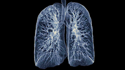 Wall Mural - CT Chest or Lung 3d rendering image  showing Trachea and lung in respiratory system..