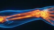 Wrist bones pain recreation, X-rays picture.