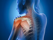 Painful shoulder joints. Frozen shoulder, impingement. 3d illustration