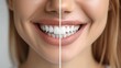 © Divine123victory - Dental care Dentistry concept, female smile after teeth whitening