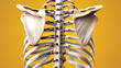 Posterior Thoracic Fusion with Pedicle Screws and Rods on Yellow Background
