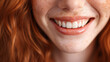 tooth whitening ad with a red head woman