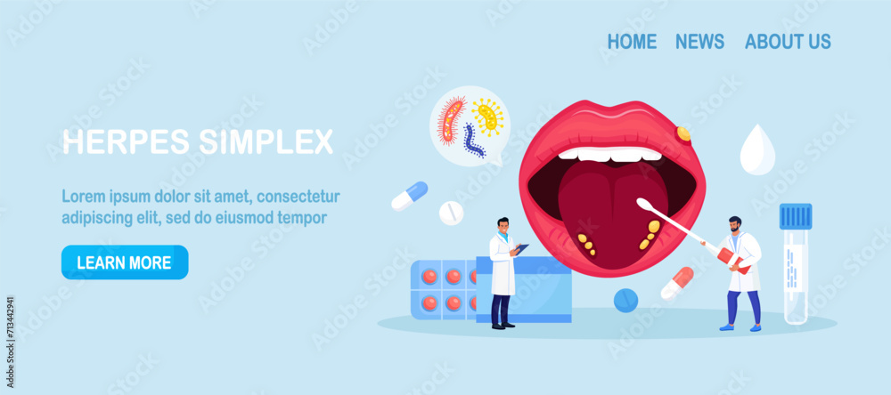 Herpes simplex virus on human lips. Dermatological disease with watery ...