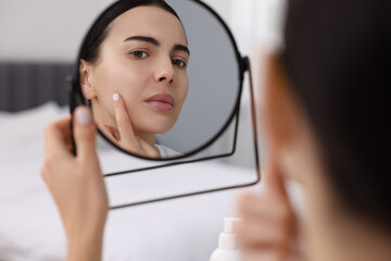 Wall Mural - Woman with dry skin looking at mirror indoors