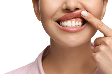 Wall Mural - Woman showing her clean teeth on white background, closeup