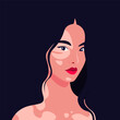 The face of a young Asian woman is half turned with vitiligo depigmentation on a dark background. Portrait of fashion model. Vector flat Illustration
