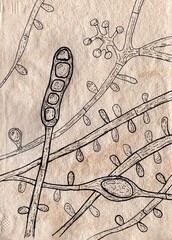 Poster - Fungus Trichophyton tonsurans, hand-drawn illustration