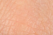© New Africa - Texture of healthy skin as background, macro view