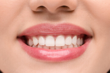 Wall Mural - Woman with clean teeth smiling, closeup view