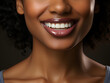 © Resdika - Close up of Smiling Young African Women with Healthy White Teeth. For Healthcare, Veneers, and Dental Advertisements