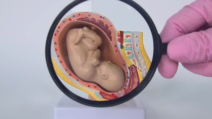 Sticker - Obstetrician gynecologist shows fetus in uterus of an anatomical model of human organ through magnifying glass. Pregnancy study