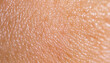 © Uuganbayar - dry and dehydrated human skin texture background; close up; high quality photo