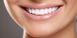 perfect smile close-up.  snow-white strong teeth