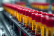 A close-up of blood samples in test tubes, arranged in a rack, awaiting analysis,