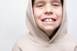 © Мар'ян Філь - A young boy shows his teeth, permanent teeth are already growing to replace milk teeth, boy has an incorrect bite, the teeth grow crooked, braces need to be installed. Dental concept