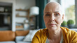Middle aged woman without hair with cancer at home, cancer survivor. 