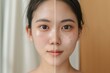 © Didikidiw61447 - Closeup skin face texture before and after facial treatment problem of spot acne blackheads on forehead young Asian woman background . Problem skincare and beauty concept.