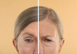 © New Africa - Aging skin changes. Woman showing face before and after rejuvenation, closeup. Collage comparing skin condition