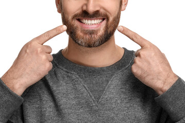 Sticker - Smiling man pointing at his healthy clean teeth on white background, closeup