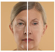 © New Africa - Aging skin changes. Woman showing face before and after rejuvenation, closeup. Collage comparing skin condition