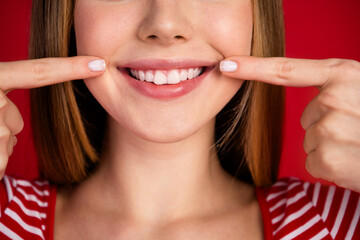 Poster - Cropped photo of funky toothy lady dressed striped top showing fingers white teeth smile isolated red color background