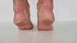 Female feet with cracks and peeling on heels isolated on a white background. Fungal skin infections, allergic diseases