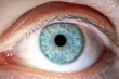 © Michael - Male Blue Colored Eye with Yellow Pigment Spots and Lashes. Pupil Opened. Close Up. Structural Anatomy. Human Iris Macro Detail.