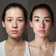 © olegganko - face treatment before and after