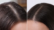 © New Africa - Woman showing hair before and after dandruff treatment, collage